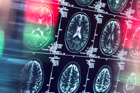 Scan des menschlichen Gehirns in einer neurologischen Klinik