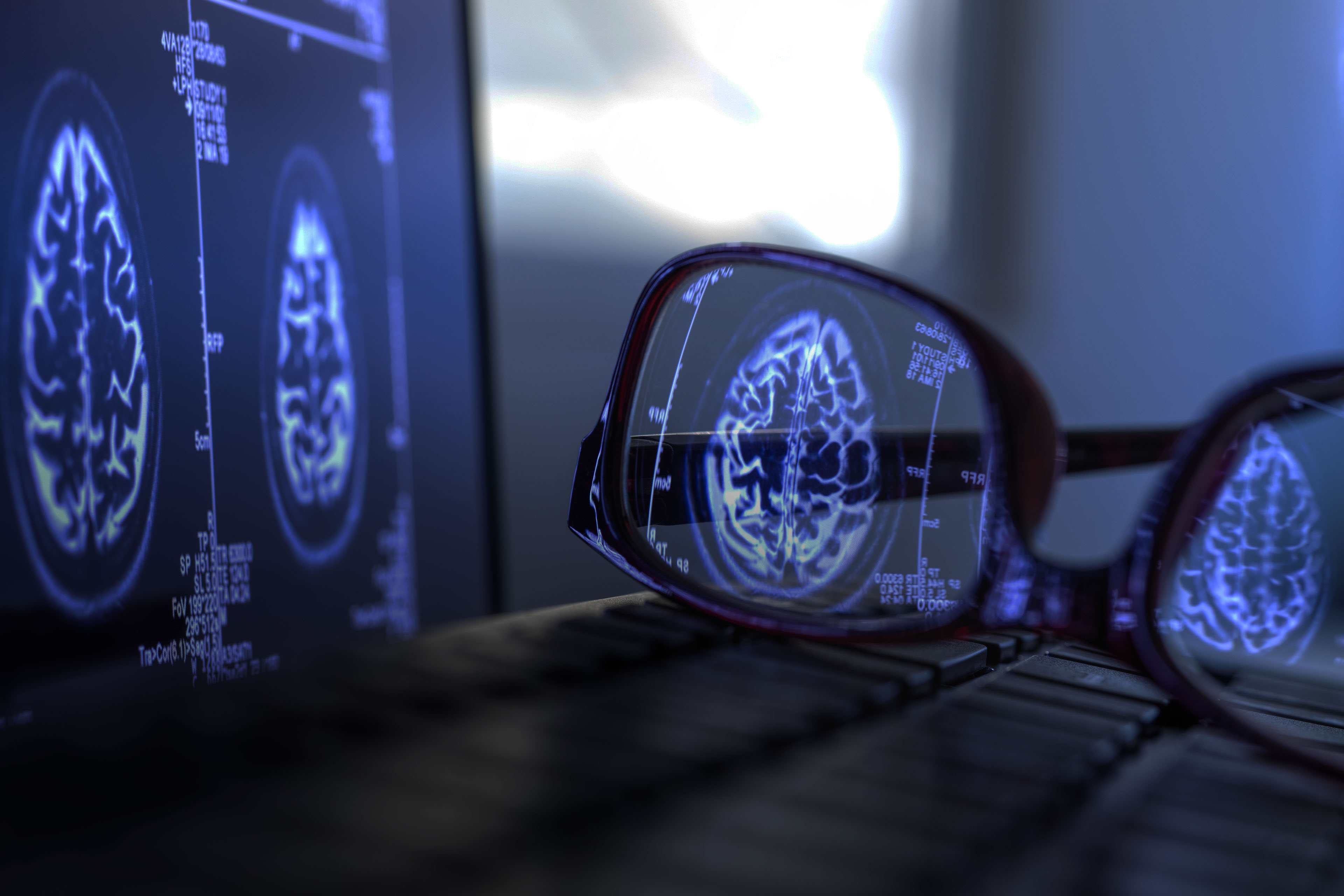 ey-brain-scan-results-reflecting-in-protective-glasses Medical Companies: Unlocking the Power of Innovation