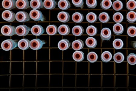 Top down shot of test tubes for medical samples